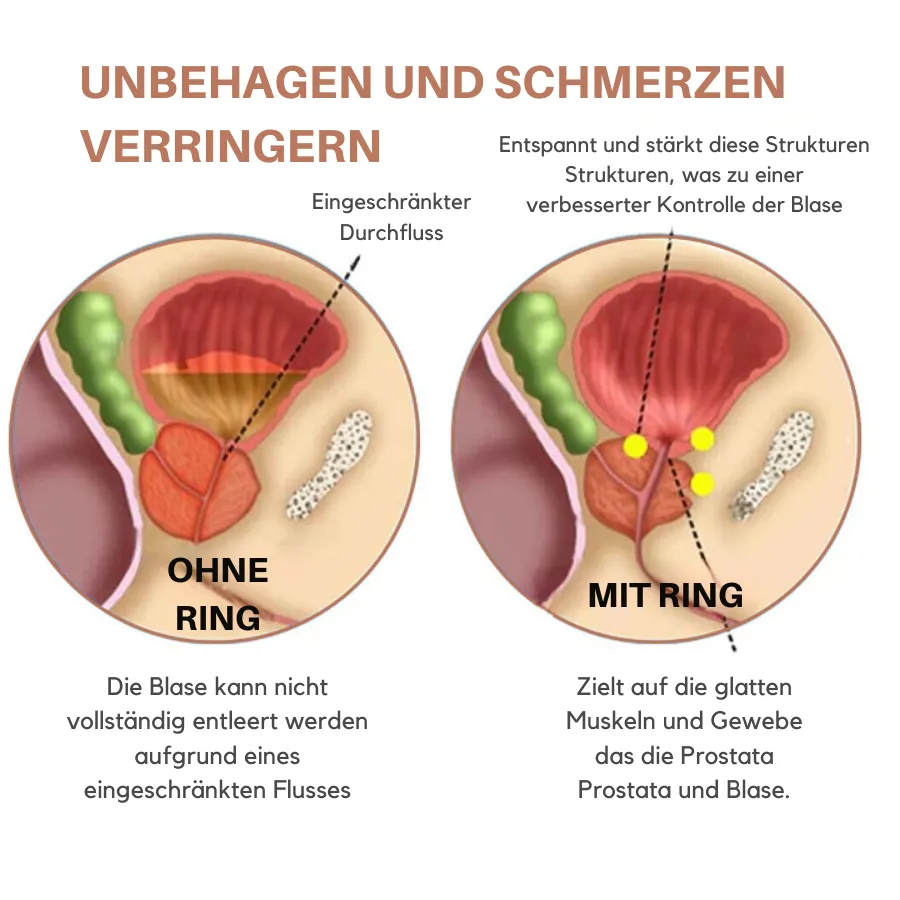 Fivfivgo™ Magnetischer Prostata-Ring aus Kupfer