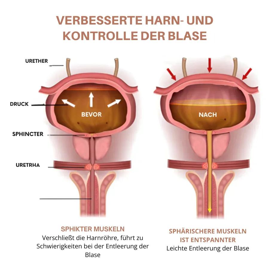 Fivfivgo™ Magnetischer Prostata-Ring aus Kupfer